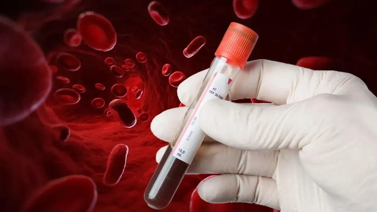 SAĞLIK
6 milyonda bir rastlanan "Altın kan" hayat kurtardı: "Altın kan" nedir, kimlerde bulunur ve özellikleri nelerdir? SAĞLIK
6 milyonda bir rastlanan "Altın kan" hayat kurtardı: "Altın kan" nedir, kimlerde bulunur ve özellikleri nelerdir?