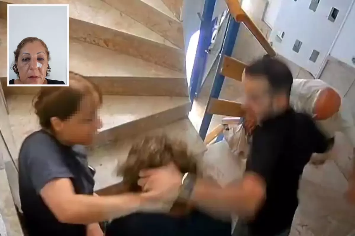 Kedi besleme kavgasında komşusunun burnunu kırdı