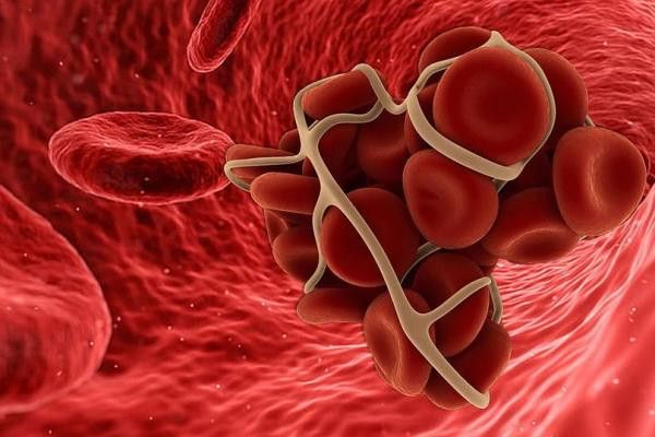 SAĞLIK
Obezite ve sigara kullanımı tromboz riskini artırıyor SAĞLIK
Obezite ve sigara kullanımı tromboz riskini artırıyor