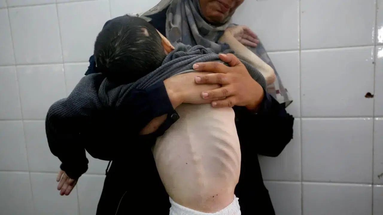 Gazze’de 453 Kişi Açlıktan Şehit Oldu Gazze’de 453 Kişi Açlıktan Şehit Oldu