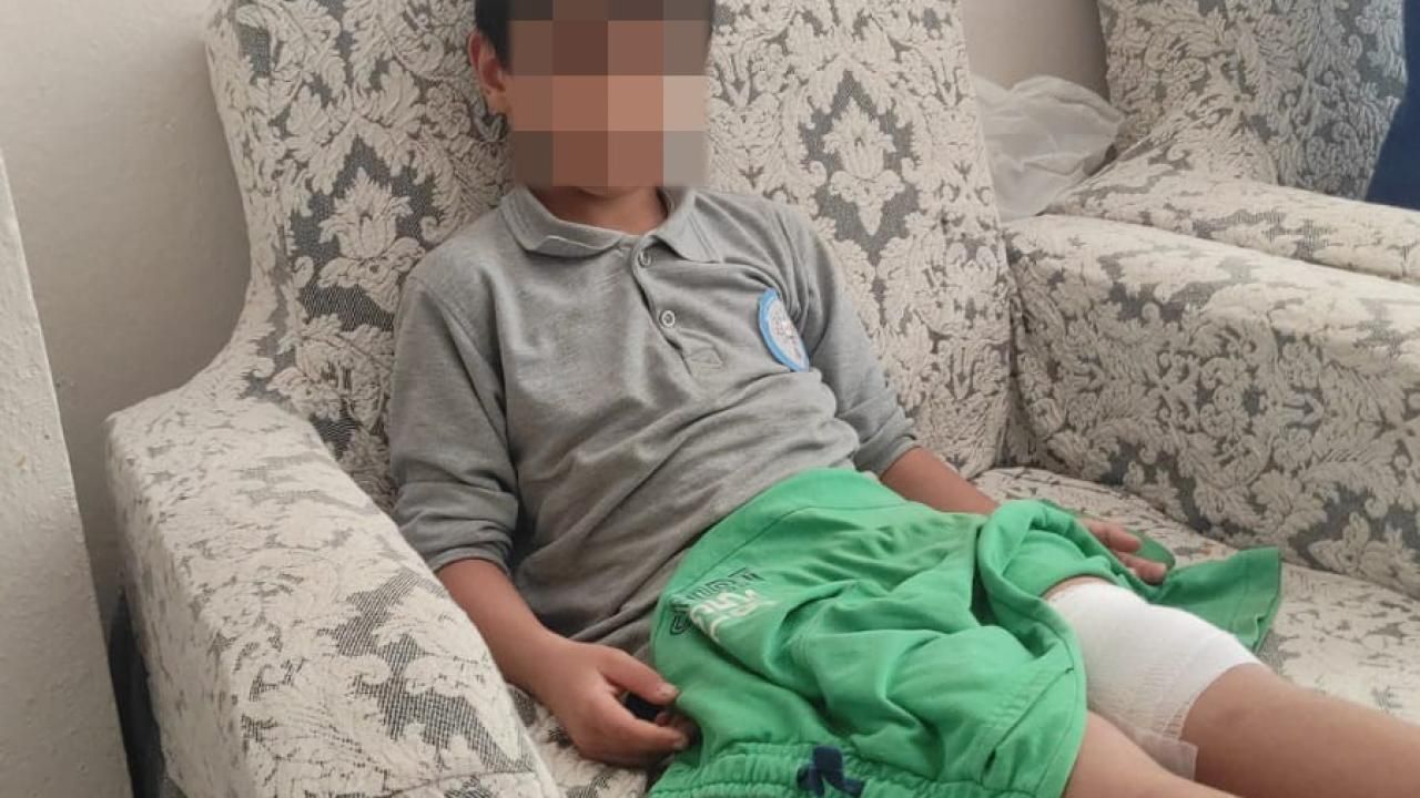 Bursa’da Okul Yolunda Köpek Saldırısı Gerçekleşti